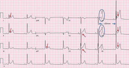 Figure 11