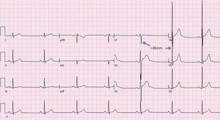 Figure 13