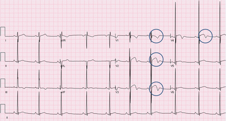 Figure 15