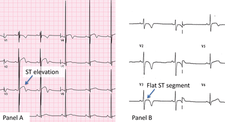 Figure 17