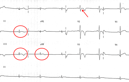Figure 9