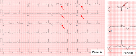 Figure 10