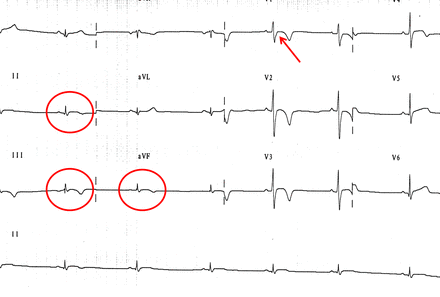 Figure 11