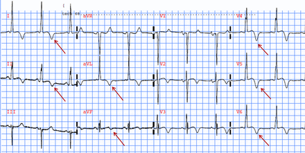 Figure 3