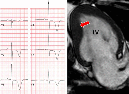 Figure 9