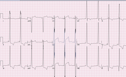 Figure 1